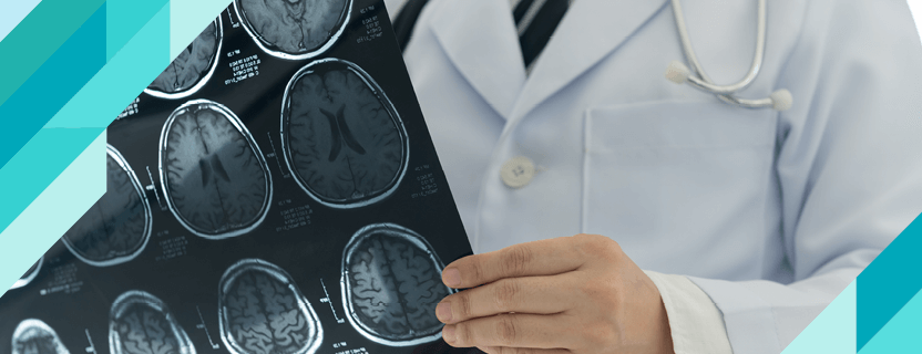 Gliomlar (Glial Tümörler) Nelerdir?