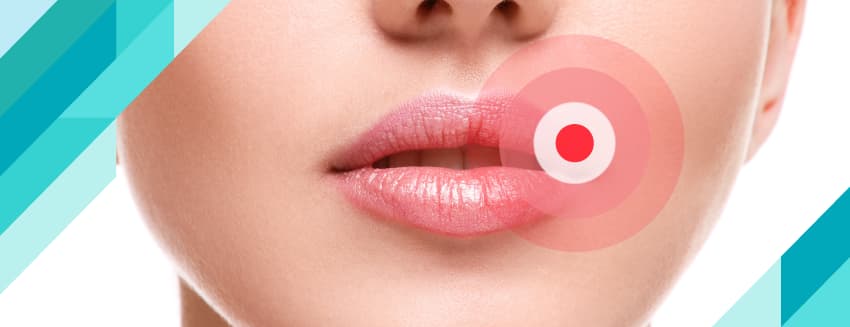 Behçet Hastalığı Nedir?