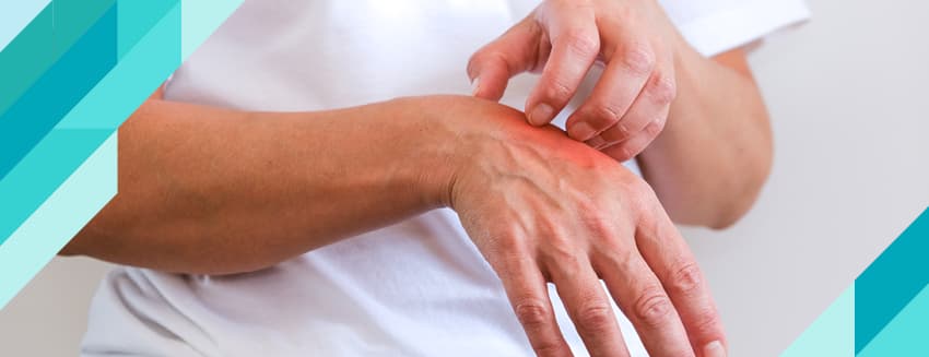 Uyuz Hastalığı Nedir? Belirtileri ve Tedavisi