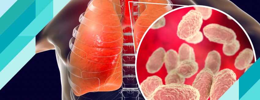 Boğmaca Hastalığı Nedir? Belirtileri Nelerdir?