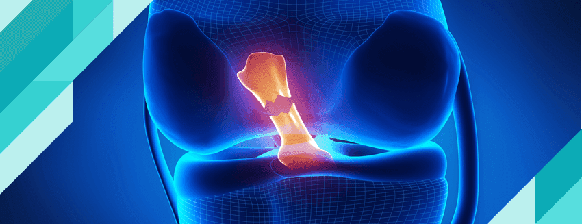 Knee Diseases
