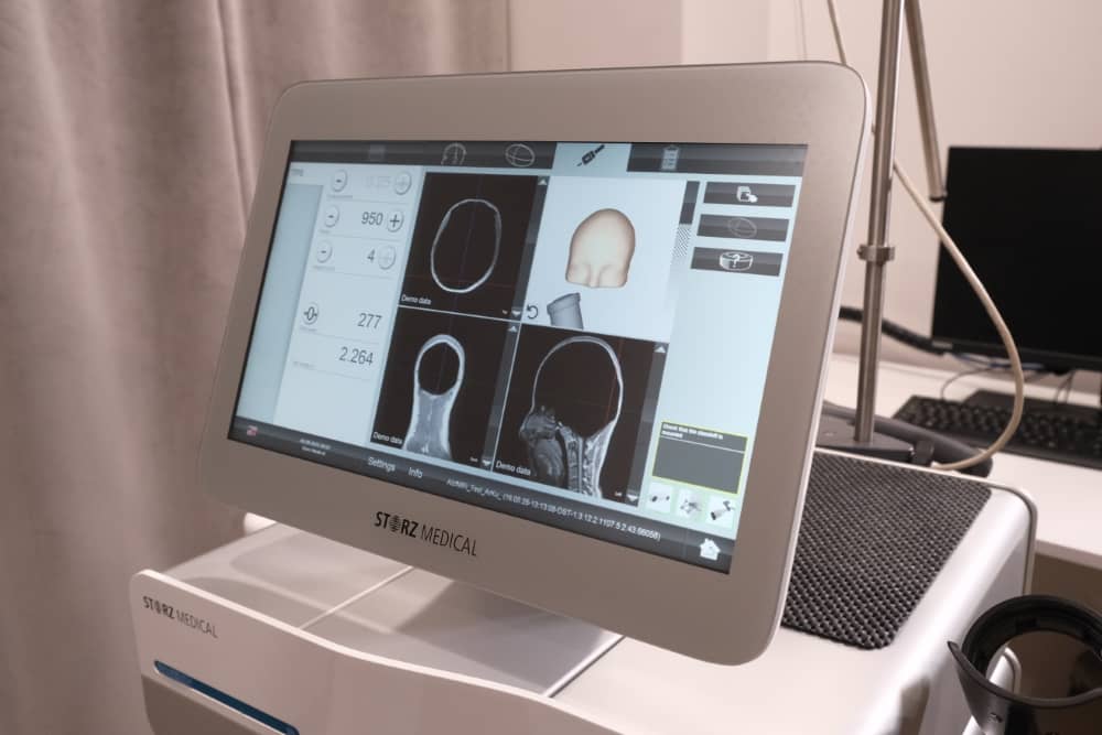 What is Electromyography (EMG)? How is EMG Performed?